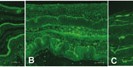 Immunfluoreszenzmarkierung der Basalmembran durch Laminin