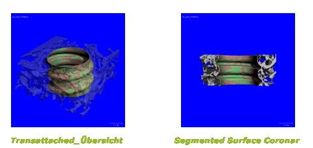 µCT-Messungen von Implantatoberflächen