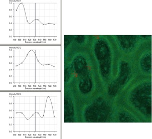 Polychrome Sequenzmarkierung mit verschiedenen Tetracyclinderivaten, Extraktion der Fluoreszenspektren mittels ACE, 20x, CLSM 510 NLO Meta